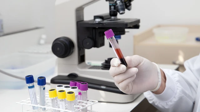 benh/soi-tui-mat.html