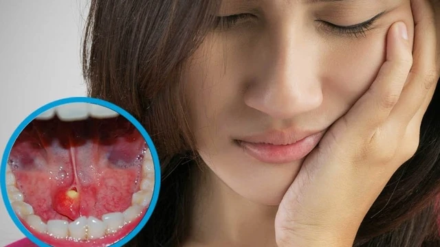 bai-viet/soi-tuyen-nuoc-bot-nhung-thong-tin-quan-trong-ban-can-biet.html