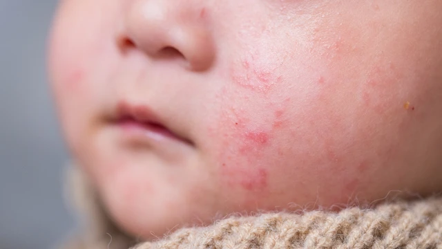 bai-viet/sot-phat-ban-co-duoc-ra-gio-khong.html