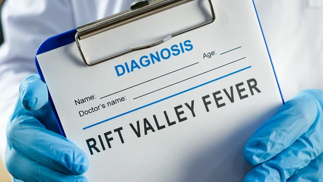 bai-viet/sot-rift-valley-trieu-chung-chan-doan-dieu-tri-va-cac-bien-phap-phong-benh.html