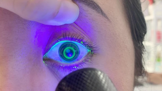 bai-viet/su-dung-kinh-ortho-k-co-het-can-khong-va-mot-so-dieu-can-biet-ve-kinh-ortho-k.html