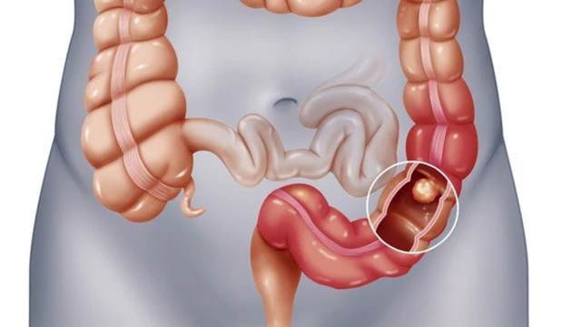 bai-viet/su-gian-doan-cua-dong-ho-sinh-hoc-lien-quan-den-su-tien-trien-nhanh-chong-cua-ung-thu-truc-trang.html