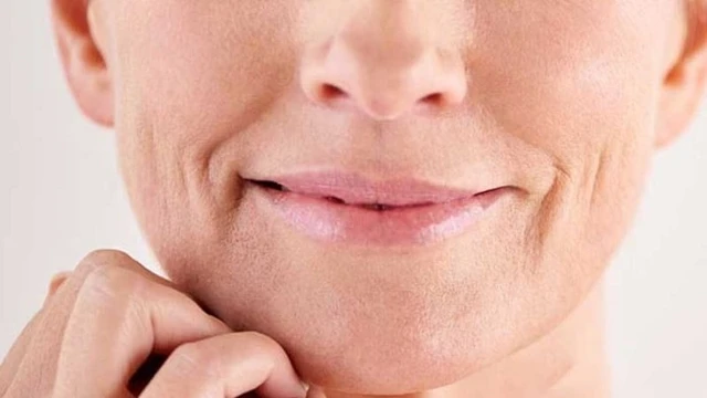 bai-viet/su-hinh-thanh-nep-nhan-khoe-mieng-do-dau.html