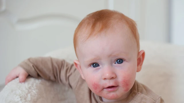 bai-viet/sua-tam-cho-be-viem-da-co-dia-va-tieu-chi-chon-sua-tam-cho-be.html