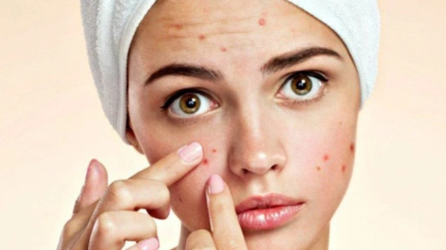 bai-viet/suc-khoe-lan-da-cach-cham-soc-da-mun-viem-khoa-hoc-nhat.html