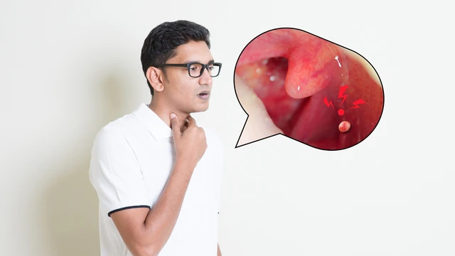 bai-viet/sui-vom-hong-o-nguoi-lon-nguyen-nhan-trieu-chung-va-cach-phong-ngua-hieu-qua.html