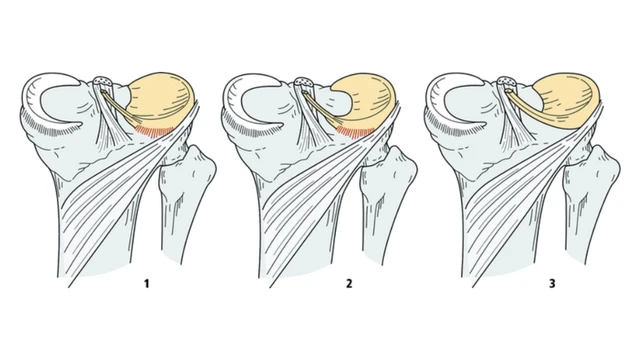 bai-viet/sun-chem-hinh-dia-co-may-loai-va-bien-phap-dieu-tri-nhu-the-nao.html