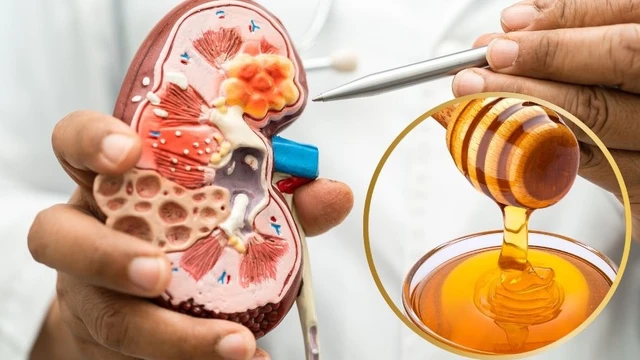 bai-viet/nguoi-bi-suy-than-co-uong-duoc-mat-ong-khong.html