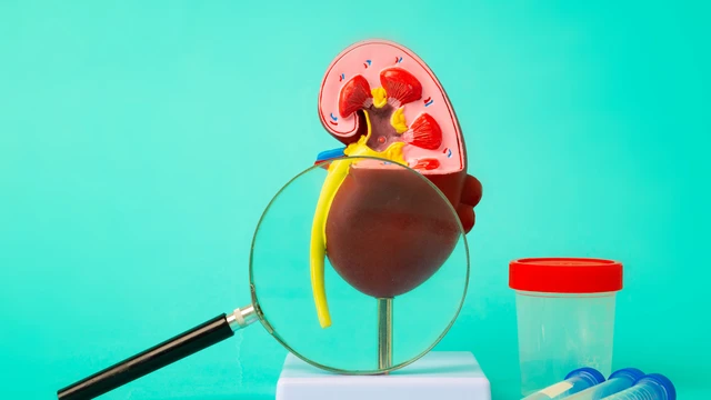 Suy tuyến thượng thận