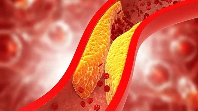 bai-viet/tac-dung-phu-cua-thuoc-lipanthyl-145mg-luu-y-truoc-khi-su-dung-thuoc.html