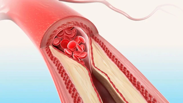 bai-viet/tac-mach-mau-co-chua-duoc-khong-dau-la-cach-dieu-tri-hieu-qua.html