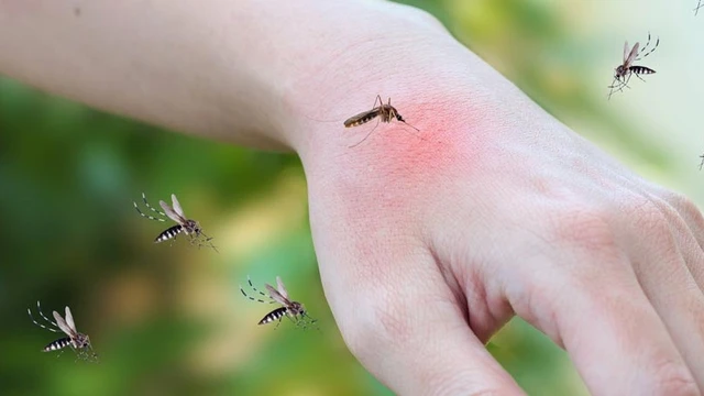 bai-viet/tai-sao-co-nguoi-bi-muoi-dot-nhieu-trong-khi-nguoi-khac-thi-khong-66288.html