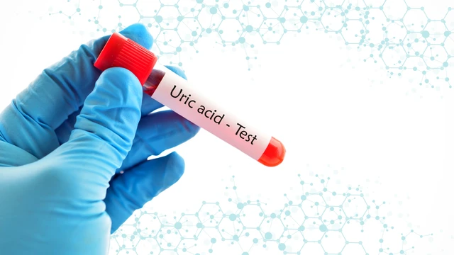 bai-viet/tai-sao-kiem-soat-axit-uric-la-quan-trong-doi-voi-nguoi-cao-tuoi.html