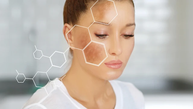 bai-viet/tai-sao-lan-da-lai-sam-mau-va-lam-the-nao-de-phuc-hoi.html