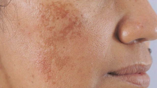 bai-viet/tai-sao-o-trong-nha-khong-ra-nang-ma-da-van-bi-den-sam.html