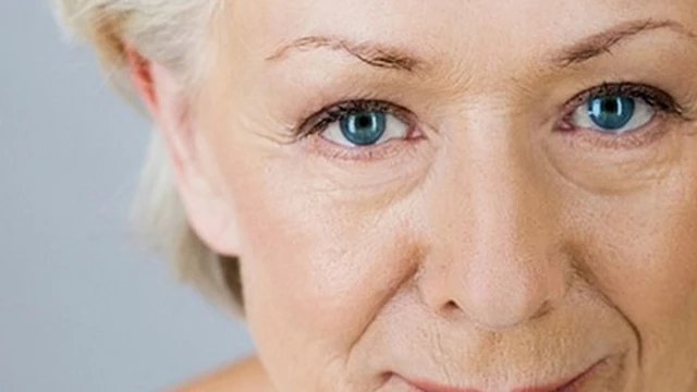 bai-viet/tai-sao-xuat-hien-nep-nhan-quanh-mat-khi-cuoi-cach-cai-thien-hieu-qua-61746.html