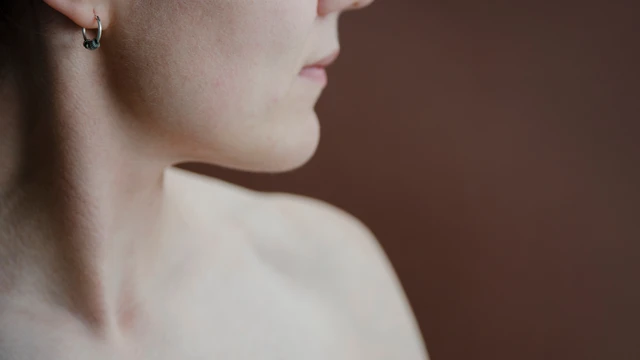 bai-viet/tai-sao-xuong-quai-ham-to-cach-khac-phuc-xuong-quai-ham-to.html