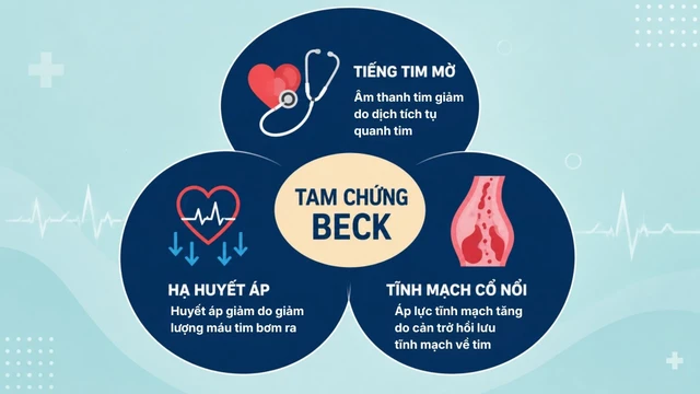 bai-viet/tam-chung-beck-la-gi-3-dau-hieu-dien-hinh-va-y-nghia-trong-chan-doan.html