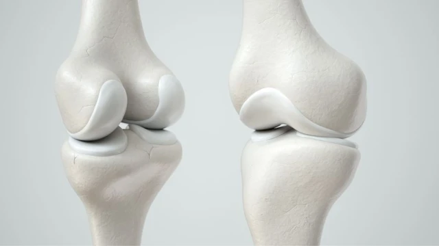 bai-viet/sun-xuong-la-gi-tam-quan-trong-cua-sun-xuong-doi-voi-co-the.html