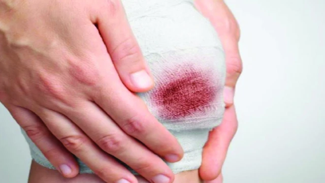 bai-viet/tam-quan-trong-cua-viec-sat-khuan-ngoai-da-truoc-cac-yeu-to-ben-ngoai.html