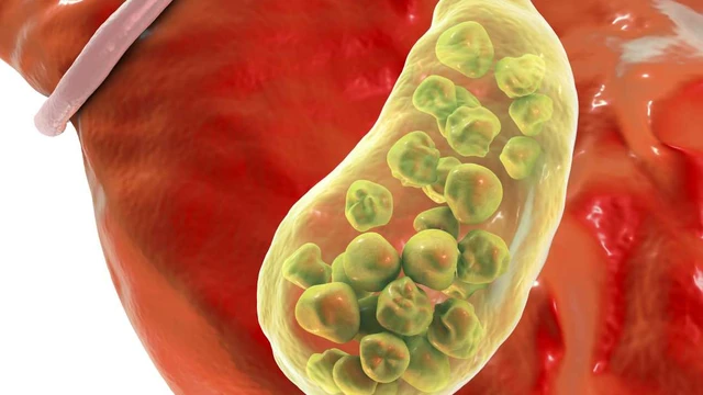 bai-viet/tan-soi-mat-qua-da-va-nhung-dieu-ma-ban-can-biet-55531.html