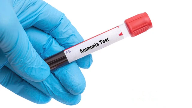 bai-viet/tang-amoniac-mau-nguyen-nhan-va-trieu-chung.html