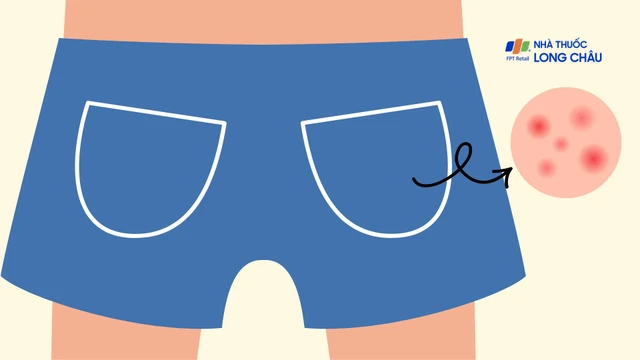 bai-viet/tay-chan-mieng-noi-o-mong-co-nguy-hiem-khong-cach-xu-ly-hieu-qua.html