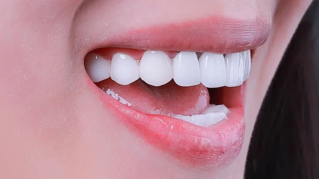 bai-viet/tay-trang-la-gi-nhung-dieu-can-luu-y-de-bao-ve-rang-sau-khi-tay-trang.html