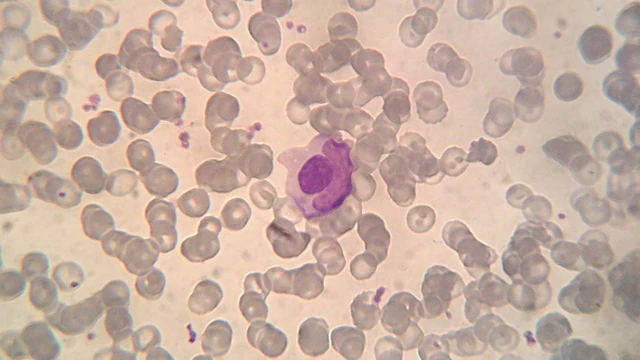 bai-viet/vai-tro-cua-xet-nghiem-te-bao-hargraves.html