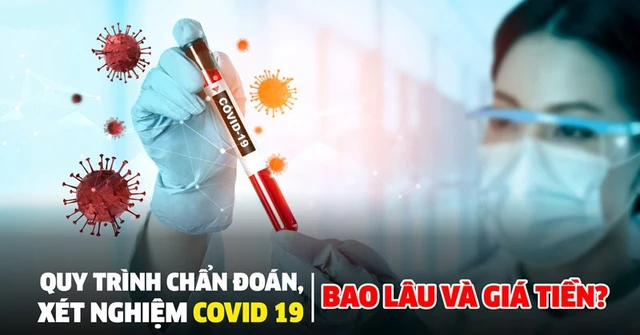 bai-viet/test-covid-nhanh-gia-bao-nhieu-tien-va-quy-trinh-nhu-the-nao-48857.html