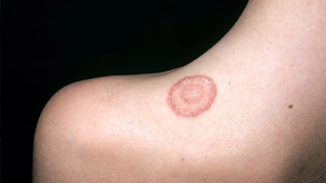 bai-viet/thac-mac-hac-lao-lay-qua-duong-nao-55326.html