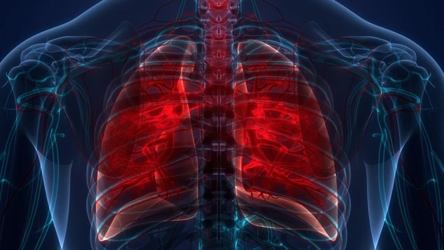 bai-viet/tham-nhiem-phoi-muc-do-ton-thuong-trong-giai-doan-lao-thu-phat.html