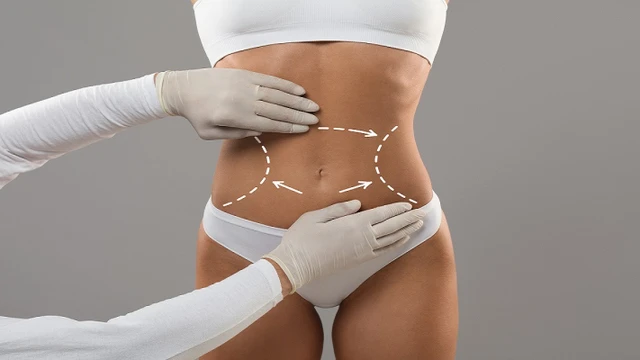 bai-viet/nhung-van-de-lien-quan-den-thoat-vi-thanh-bung-ma-ban-can-biet.html