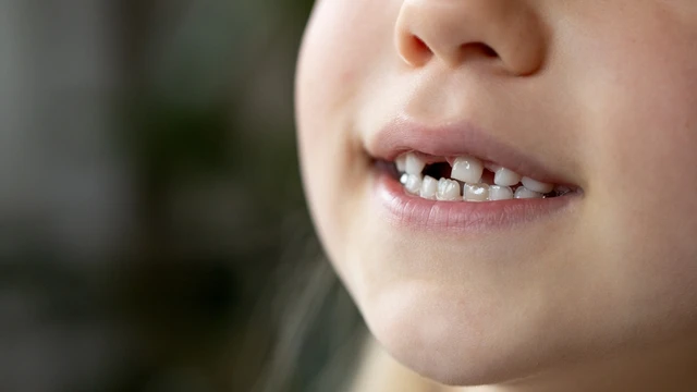 bai-viet/thay-rang-som-co-day-thi-som-khong-nhung-dieu-cha-me-can-biet.html