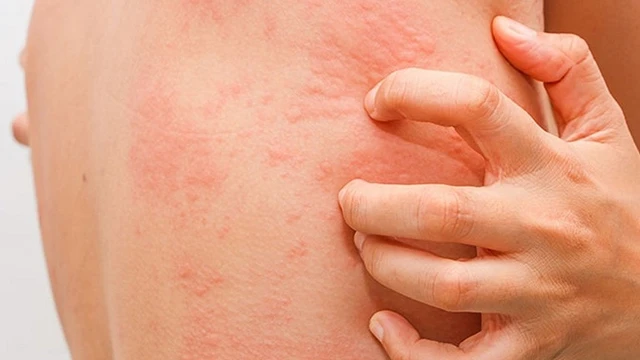 bai-viet/the-nao-la-me-day-man-tinh-tu-mien-54740.html