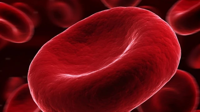 bai-viet/the-tich-khoi-hong-cau-giam-nguyen-nhan-va-cach-dieu-tri.html