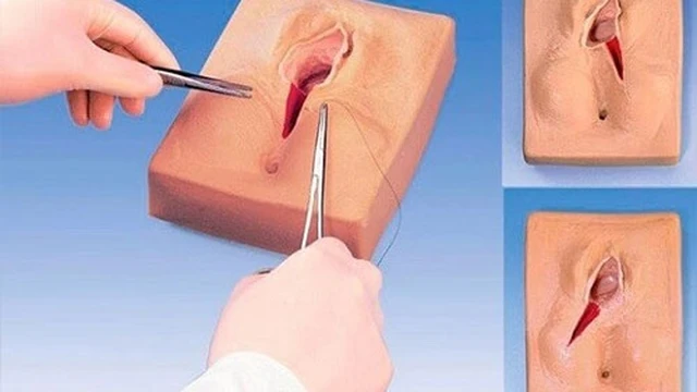 bai-viet/nguyen-nhan-gay-thit-thua-o-moi-be-phu-nu-cach-dieu-tri.html