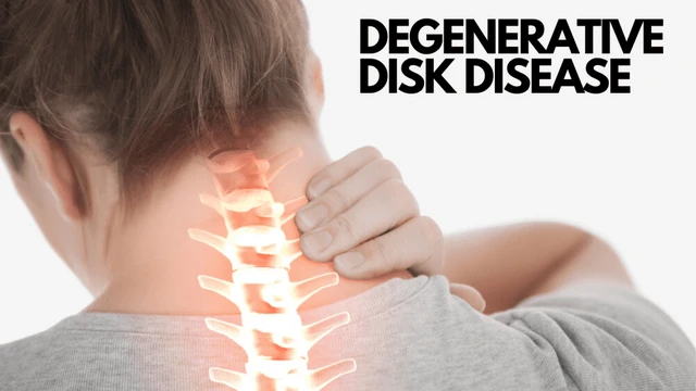 benh/thoai-hoa-dia-dem.html