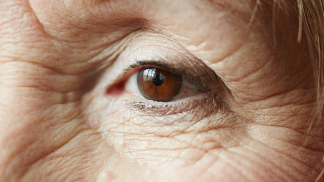 bai-viet/macular-degeneration-la-gi-nguyen-nhan-va-trieu-chung-cua-benh.html