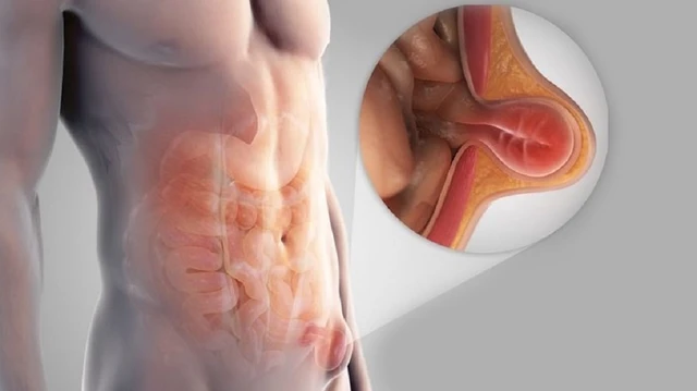 bai-viet/thoat-vi-ben-co-nguy-hiem-khong-nguyen-nhan-va-cach-dieu-tri.html