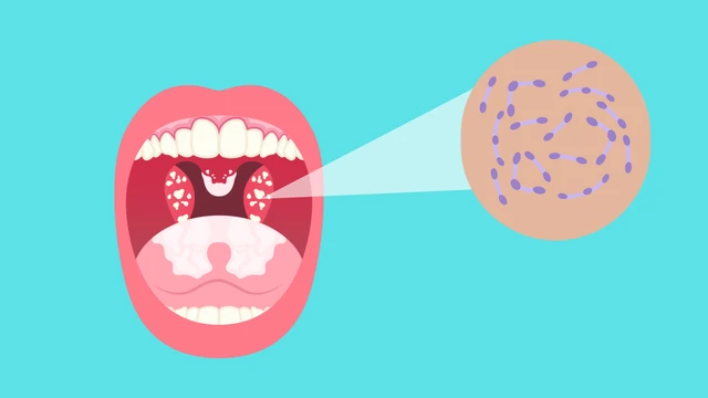 bai-viet/thoi-gian-u-benh-bach-hau-bao-lau-bien-phap-phong-ngua-benh.html