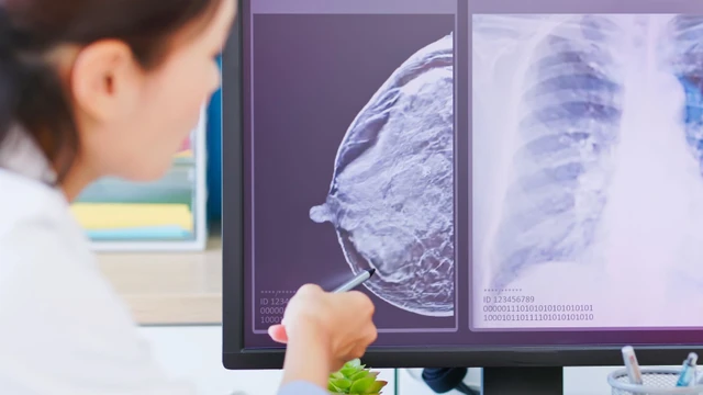 bai-viet/cac-thoi-quen-xau-gay-ung-thu-vu-can-tranh.html