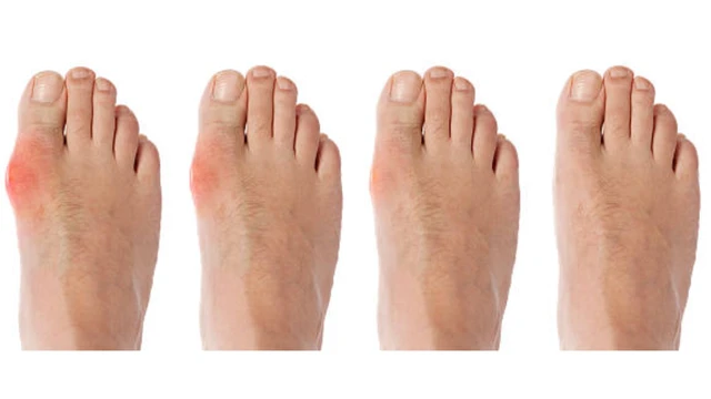 bai-viet/thong-phong-la-benh-gi-lieu-ban-co-dang-mac-phai.html