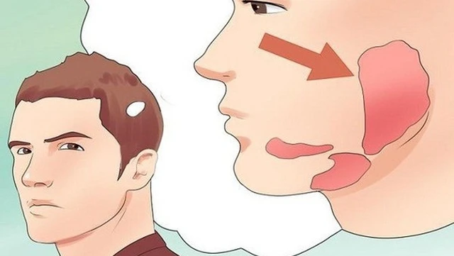 bai-viet/thong-tin-ve-thu-thuat-cat-tuyen-duoi-ham.html