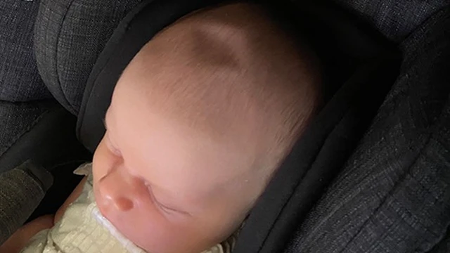 bai-viet/thop-tre-so-sinh-khong-phap-phong-co-sao-khong.html