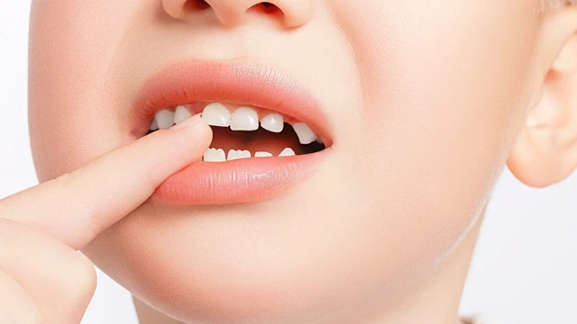 bai-viet/thu-tu-moc-rang-sua-o-tre-ma-bo-me-nen-biet.html