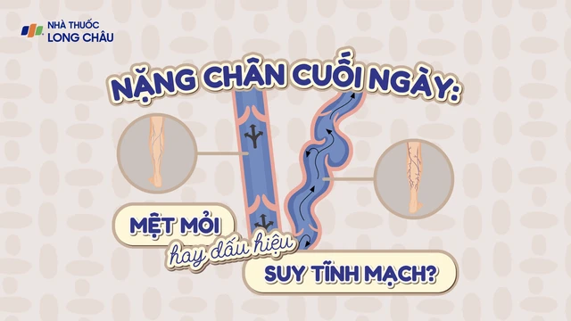 bai-viet/infographic-nang-chan-cuoi-ngay-met-moi-hay-dau-hieu-suy-tinh-mach.html