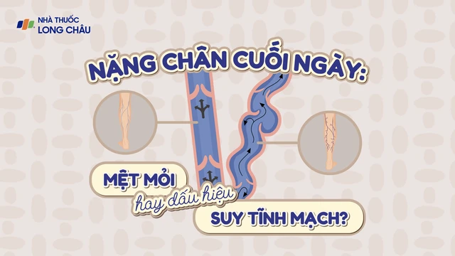 bai-viet/infographic-nang-chan-cuoi-ngay-met-moi-hay-dau-hieu-suy-tinh-mach.html