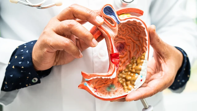 benh/thung-da-day-132.html