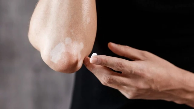 bai-viet/thuoc-boi-lang-ben-do-hieu-qua-53034.html